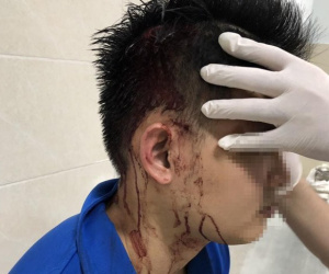 Nam thanh niên bị đánh hội đồng, bắn đạn bi vào đầu trước cửa trung tâm thương mại