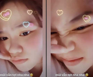 Bạn gái Quang Hải đăng clip cận cảnh day mũi trên trang cá nhân, dập tắt tin đồn dao kéo