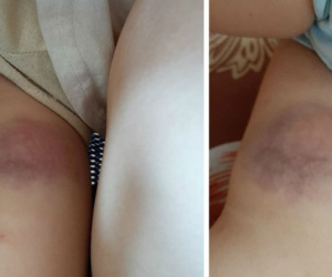Thêm một nạn nhân của 'thánh thực dưỡng' tự phong: Cái chết tức tưởi của bé gái hơn 30 tháng tuổi