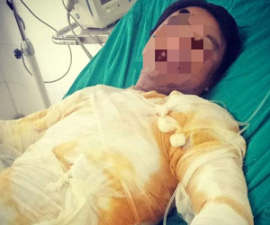 Đình chỉ 8 người liên quan vụ công nhân bị điện giật bỏng nặng
