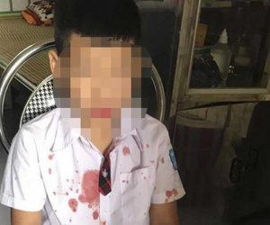 Phụ huynh vào trường đưa bé trai lớp 1 ra ngoài hành hung để giải quyết mâu thuẫn cho con