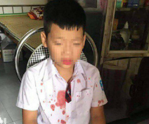 Bé trai lớp 1 bị người đàn ông hành hung để 'trả thù' đang hoảng loạn, không muốn đến trường học