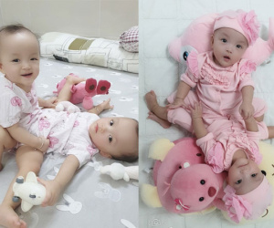 Sẵn sàng cho ca mổ tách dính 2 bé gái 'dùng chung một bỉm' tại BV Nhi Đồng TP.HCM