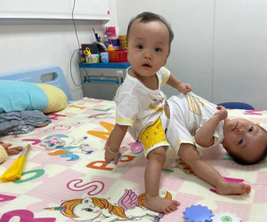 Lời cầu nguyện của Giám đốc BV Nhi trước đại phẫu 100 bác sĩ cho cặp song sinh dính liền