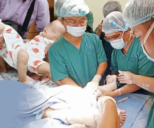 Bác sĩ ekip chỉnh hình trong ca tách song sinh Trúc Nhi - Diệu Nhi tiết lộ khoảnh khắc cuối cùng: Vừa bó bột xong là… muốn gục