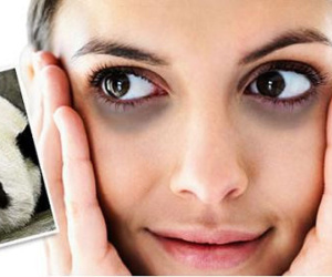 Tại sao thức khuya mắt hay bị thâm quầng?