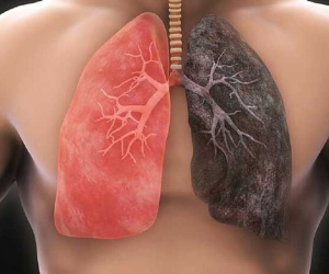 Thuốc lá tàn phá cơ thể thế nào?