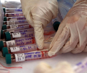 Chuyên gia cảnh báo: Test nhanh âm tính không có nghĩa bạn hoàn toàn không nhiễm SARS-COV-2
