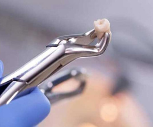 Chàng trai 26 tuổi chết vì xuất huyết não sau khi nhổ răng khôn, cảnh báo những lưu ý khi nhổ răng khôn
