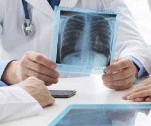 2 chị em gái cùng mắc bệnh ung thư phổi, tìm hiểu gia đình mới biết họ có nguy cơ mắc bệnh cao gấp 5-7 lần so với người khác