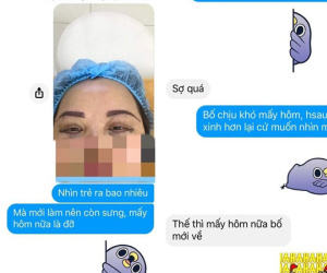 Mẹ đi phẫu thuật thẩm mỹ, con nhắn tin cho bố để báo tin và lời đáp trả bất ngờ