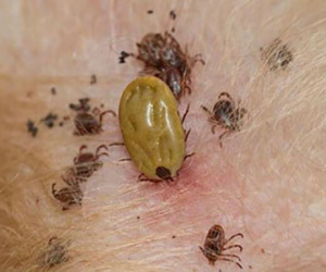 Virus Bunya bùng phát ở Trung Quốc: Đã xuất hiện từ 10 năm trước, gây chết người, lây bệnh qua máu và vết thương hở