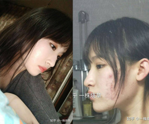 Gái xinh công khai chuyện photoshop da để sống ảo, nói hộ nỗi lòng của team bị mụn hành hạ