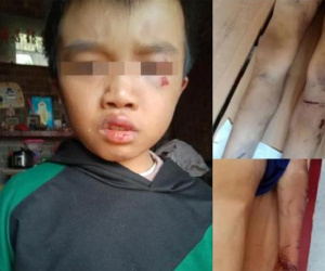 Bé trai bị bố mẹ hành hạ đến chết, ông nội nhận tin bủn rủn rồi bàng hoàng nhớ đến lời nói của đứa trẻ vài ngày trước với bà nội