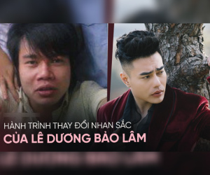 Hành trình 'dao kéo' đau đớn của Lê Dương Bảo Lâm: Chấp nhận phẫu thuật 10 ngày/lần, 3 phen cưa răng theo trend