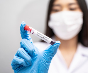 Phát hiện virus corona trên mẫu da người