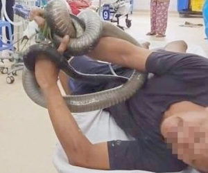 Người đàn ông bị rắn hổ mang chúa cắn đã tỉnh hoàn toàn sau khi được truyền huyết thanh chống độc