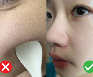 Dùng serum chứa Hyaluronic Acid để cấp ẩm thì quá chuẩn, nhưng bôi sai cách thì da sẽ khô như bị vắt kiệt nước