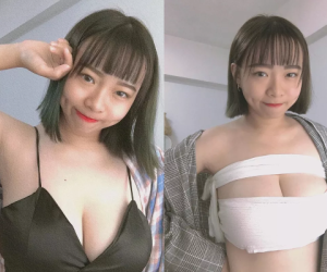 'Đắng lòng' nữ sinh ngành Điều dưỡng phải quấn băng mỗi ngày vì lý do khó đỡ