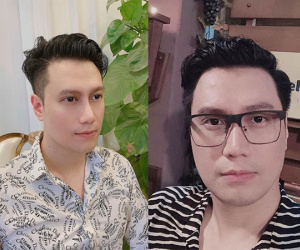 Việt Anh nhận được nhiều lời khen ngợi khi công khai ảnh chụp cận gương mặt sau 1 năm phẫu thuật thẩm mỹ