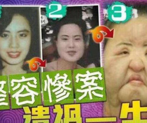Xót xa 'thảm hoạ dao kéo' Han Mi Ok: Mỹ nhân biến dạng vì nghiện thẩm mỹ, mua dầu ăn về tự tiêm và cái chết bí ẩn tuổi 57