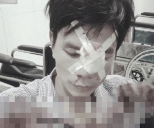 Nam thanh niên tố bị cán bộ địa chính xã dùng xẻng đánh vào mặt sau va chạm giao thông