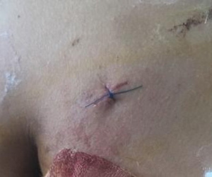 Xô xát trong bãi gửi xe, nam sinh lớp 11 đâm nam sinh lớp 12 trọng thương