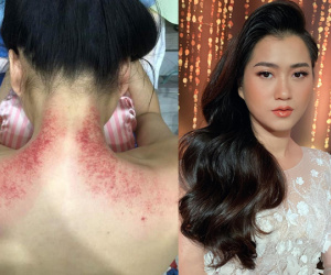 Lộ lưng trần rướm máu, Lâm Vỹ Dạ tức tưởi: 'Bệnh cũng ráng cày tiền nuôi con ăn học, vậy mà bọn xấu xa đâu có tha'
