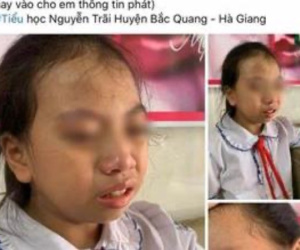 Hà Giang: Tạm đình chỉ cô giáo tát học sinh lớp 4