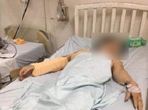 Công an vào cuộc vụ chồng đánh đập vợ cũ dã man ở Phú Yên