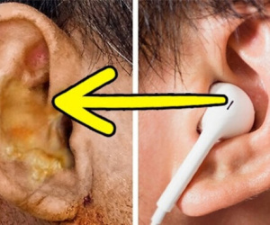 Hiểm họa khôn lường từ việc dùng chung tai nghe