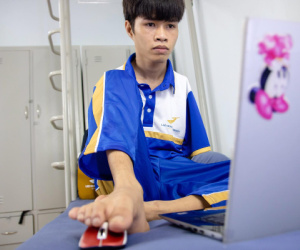 Cậu bé 'chim cánh cụt' không tay ngày nào đã trở thành sinh viên, còn được làm việc trong Google