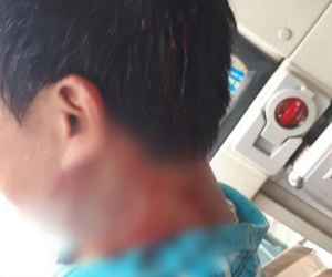 Hà Nội: Nhân viên phụ xe khách bị đánh gục khi vừa rời cổng bến xe Giáp Bát