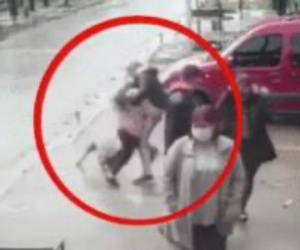 Video: Đang đi dạo với mẹ, bé gái 7 tuổi bị pitbull tấn công suýt mất chân