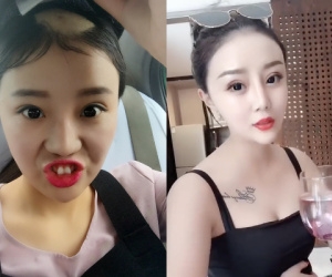 Bất ngờ công khai dao kéo, cô gái mất mảng tóc vì ăn ngô bằng khoan ngày nào nhận vô số gạch đá từ fan hâm mộ