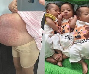Cô gái trẻ sinh 3 con trai với chiếc bụng rạn 'nổi tiếng': Nỗi lo cơm áo và những điều vượt quá tưởng tượng