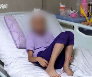 Bé gái 8 tuổi phải phẫu thuật não do sâu răng, cảnh báo không coi thường vệ sinh răng miệng