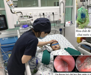 Bé 3 tuổi nguy kịch vì uống nhầm hóa chất