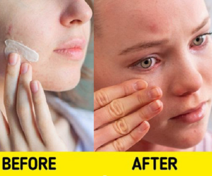 Tác hại khó lường khi sử dụng 7 sản phẩm chăm sóc da này sai cách