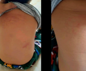 Vụ việc gây bức xúc: Cháu bé mầm non bị cô giáo bạo hành trong nhà vệ sinh, 1 cô khác thờ ơ đứng xem, dửng dưng như không có gì