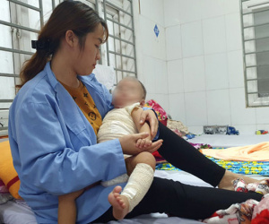 Thầy lang chữa bỏng giá 25 triệu đồng khiến bé trai bị hoại tử da
