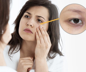 Bất kể nam hay nữ trên cơ thể xuất hiện '2 đen 2 hôi' chứng tỏ suy giảm chức năng thận