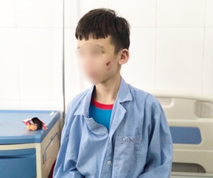 Nhân viên 15 tuổi bị chủ quán bánh xèo đánh đập dã man: 'Em kể với anh trai nhưng lại bị anh chửi'