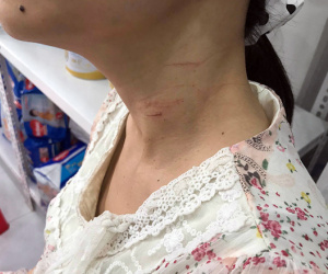 Thai phụ đã nhanh trí khi bị khống chế bằng dao