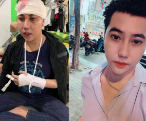 Nghi bị đánh bầm dập do làm clip cà khịa, thánh xịt nước hoa 'chịu không chịu thì thôi' nói gì?