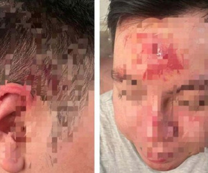Làm rõ vụ nhân viên quán bar đánh khách vì mời rượu không uống