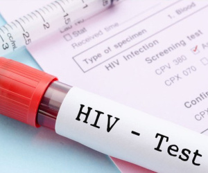 Vì sao độ tuổi được xét nghiệm HIV tự nguyện giảm xuống đủ 15 tuổi?