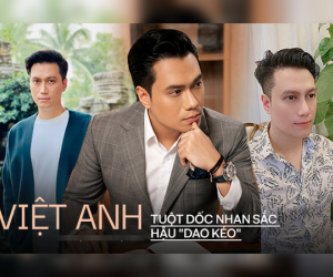 Quá trình tuột dốc nhan sắc của Việt Anh hậu 'dao kéo': Gương mặt méo mó đến đáng lo, còn đâu visual vạn người mê một thời?