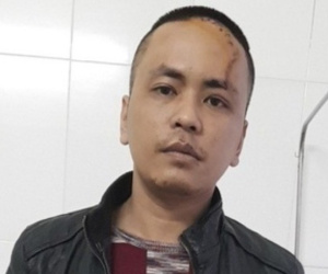 Khởi tố 'Ngáo đá' đánh cha già, chém công an xã trọng thương