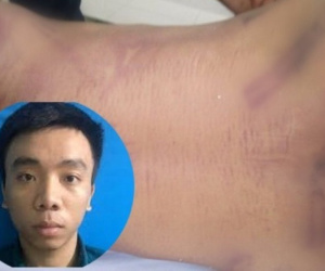 Ngày mai, xét xử vụ phạm nhân bị đánh chết tại nhà tạm giữ